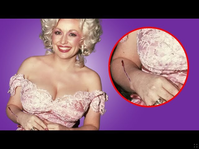 Why Does Dolly Parton Wear Long Sleeves – Complete Guide 2025